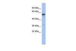 Aviva Systems Biology Corp ZNF146 Antibody - middle region (ARP35828_P050)