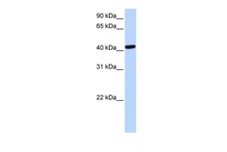 Aviva Systems Biology Corp TARDBP Antibody - N-terminal region (ARP35838_P050)