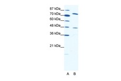 Aviva Systems Biology Corp ZNF225 Antibody - N-terminal region (ARP35871_T100)