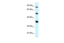 Aviva Systems Biology Corp ZNF232 Antibody - N-terminal region (ARP35880_P050)