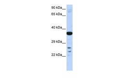 Aviva Systems Biology Corp VSX1 Antibody - middle region (ARP35883_P050)