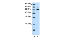 Aviva Systems Biology Corp TRIP4 Antibody - middle region (ARP35908_T100)