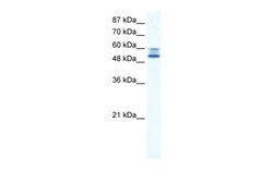 Aviva Systems Biology Corp JMJD2D Antibody - C-terminal region (ARP35946_T100)