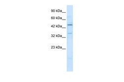 Aviva Systems Biology Corp ZNF358 Antibody - N-terminal region (ARP35948_T100)