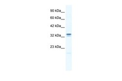 Aviva Systems Biology Corp ANKZF1 Antibody - N-terminal region (ARP35950_P050)