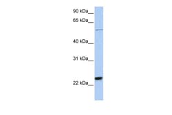 Aviva Systems Biology Corp ZNF83 Antibody - N-terminal region (ARP35952_P050)