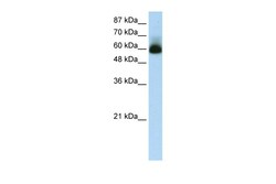 Aviva Systems Biology Corp ZNF307 Antibody - N-terminal region (ARP35963_T100)