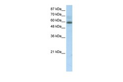 Aviva Systems Biology Corp ZNF307 Antibody - middle region (ARP35964_T100)