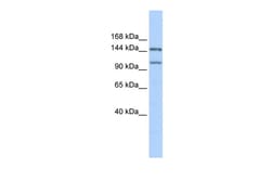 Aviva Systems Biology Corp PRDM9 Antibody - middle region (ARP35967_P050)