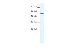 Aviva Systems Biology Corp ZNF286 Antibody - N-terminal region (ARP35973_P050)