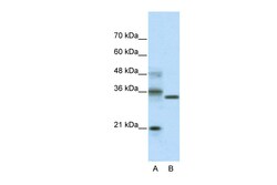 Aviva Systems Biology Corp HES4 Antibody - N-terminal region (ARP35999_T100)