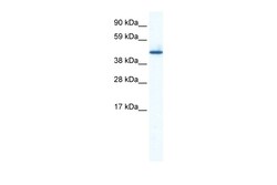 Aviva Systems Biology Corp ZNF557 Antibody - middle region (ARP36033_P050)