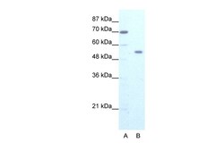 Aviva Systems Biology Corp ZNF665 Antibody - N-terminal region (ARP36042_T100)