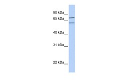 Aviva Systems Biology Corp ZNF671 Antibody - N-terminal region (ARP36045_P050)