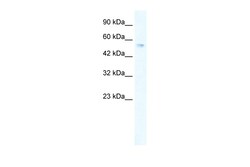 Aviva Systems Biology Corp ZNF613 Antibody - C-terminal region (ARP36048_P050)