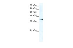Aviva Systems Biology Corp ZNF556 Antibody - C-terminal region (ARP36050_T100)