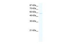 Aviva Systems Biology Corp ZNF559 Antibody - N-terminal region (ARP36069_T100)