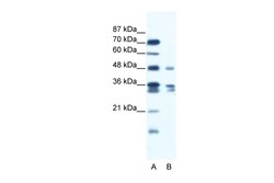 Aviva Systems Biology Corp ZNF577 Antibody - C-terminal region (ARP36077_T100)