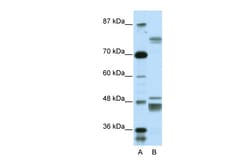 Aviva Systems Biology Corp ZNF607 Antibody - middle region (ARP36078_P050)