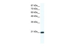 Aviva Systems Biology Corp RAXL1 Antibody - N-terminal region (ARP36080_T100)