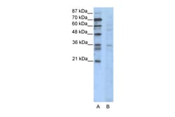 Aviva Systems Biology Corp CCNB3 Antibody - N-terminal region (ARP36087_T100)