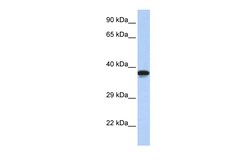 Aviva Systems Biology Corp DMRTC2 Antibody - N-terminal region (ARP36091_P050)