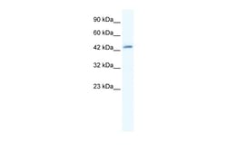 Aviva Systems Biology Corp DMRTB1 Antibody - middle region (ARP36094_T100)