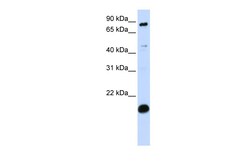 Aviva Systems Biology Corp SP110 Antibody - C-terminal region (ARP36125_P050)