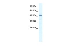 Aviva Systems Biology Corp SP140L Antibody - middle region (ARP36135_T100)