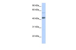 Aviva Systems Biology Corp PRDM15 Antibody - C-terminal region (ARP36148_P050)