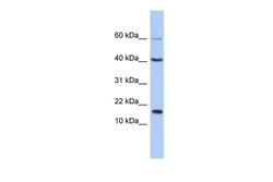 Aviva Systems Biology Corp ATOH7 Antibody - C-terminal region (ARP36152_P050)