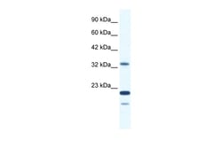 Aviva Systems Biology Corp ZNF688 Antibody - middle region (ARP36154_T100)