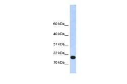 Aviva Systems Biology Corp LOC115648 Antibody - middle region (ARP36158_P050)