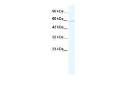 Aviva Systems Biology Corp ZNF276 Antibody - middle region (ARP36165_T100)