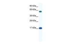 Aviva Systems Biology Corp ZNF554 Antibody - N-terminal region (ARP36167_P050)