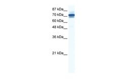 Aviva Systems Biology Corp ZNF690 Antibody - middle region (ARP36179_P050)