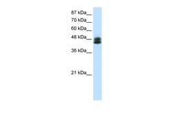 Aviva Systems Biology Corp ZNF785 Antibody - C-terminal region (ARP36183_P050)
