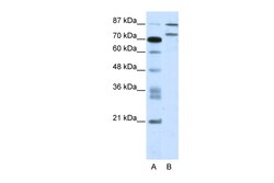 Aviva Systems Biology Corp ZNF709 Antibody - N-terminal region (ARP36195_T100)