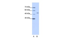 Aviva Systems Biology Corp ZNF555 Antibody - N-terminal region (ARP36204_P050)