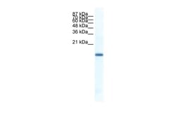 Aviva Systems Biology Corp FERD3L Antibody - N-terminal region (ARP36206_P050)