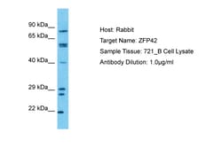 Aviva Systems Biology Corp ZFP42 Antibody - N-terminal region (ARP36244_P050)
