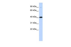 Aviva Systems Biology Corp ZFP42 Antibody - middle region (ARP36245_P050)