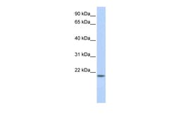 Aviva Systems Biology Corp FLJ33706 Antibody - C-terminal region (ARP36270_P050)