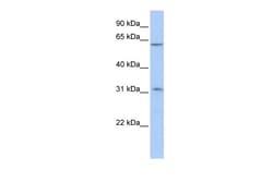 Aviva Systems Biology Corp ZNF677 Antibody - C-terminal region (ARP36274_P050)