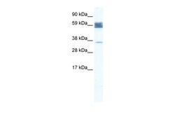Aviva Systems Biology Corp ZNF713 Antibody - N-terminal region (ARP36276_T100)