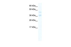 Aviva Systems Biology Corp ZNF17 Antibody - N-terminal region (ARP36291_P050)