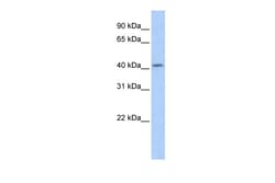 Aviva Systems Biology Corp SOHLH1 Antibody - middle region (ARP36303_P050)