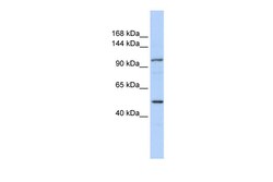 Aviva Systems Biology Corp KIAA1618 Antibody - N-terminal region (ARP36307_P050)