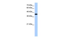 Aviva Systems Biology Corp AKAP7 Antibody - middle region (ARP36332_T100)