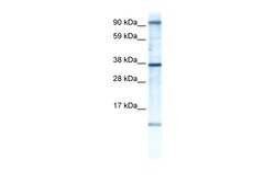Aviva Systems Biology Corp AKAP7 Antibody - N-terminal region (ARP36333_P050)